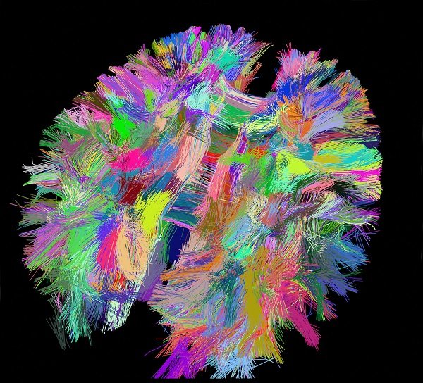 marquage multicolore d'un cortex de souris